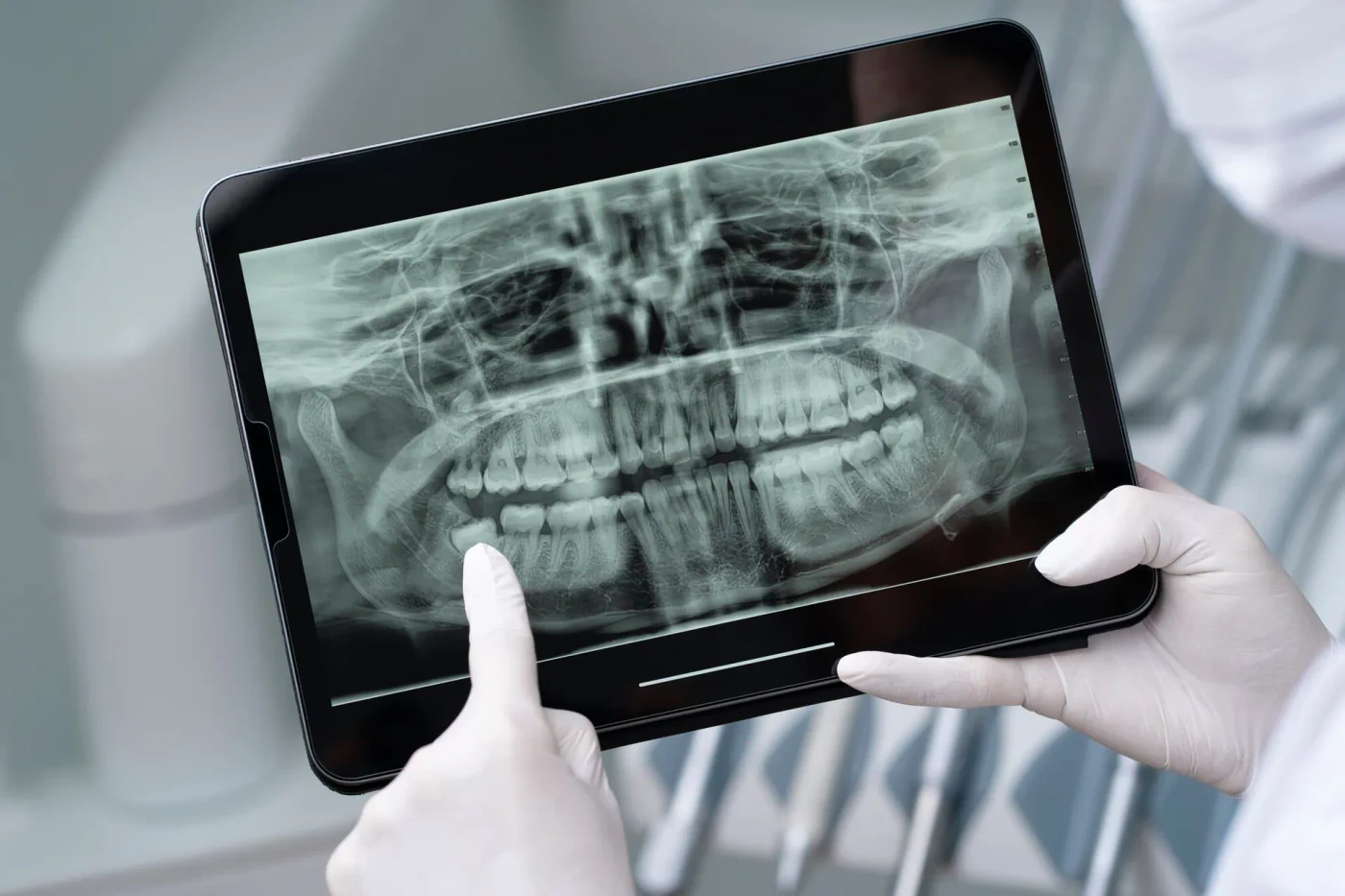 Digital Dental Radiography at Kolabhagathu Dental